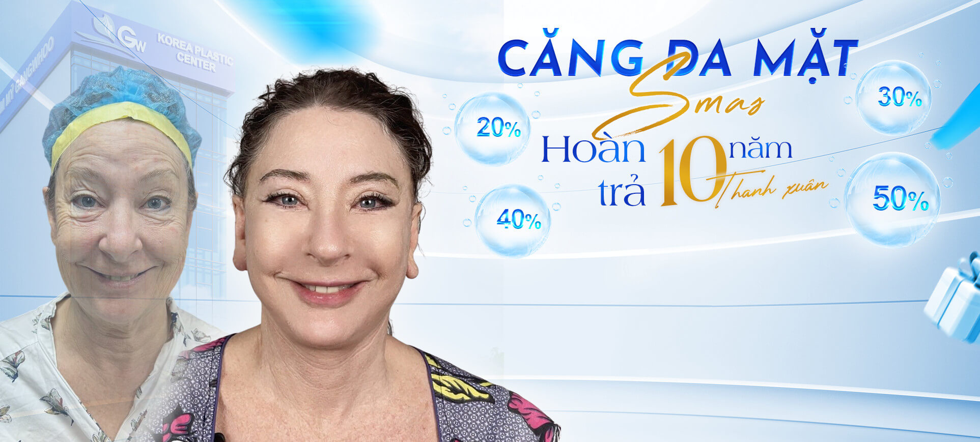 LDP cang da 22 1
