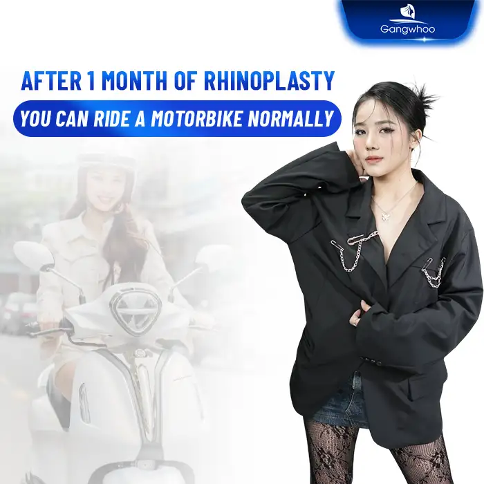 How long after rhinoplasty can you ride a motorbike? Safety tips to keep in mind when driving