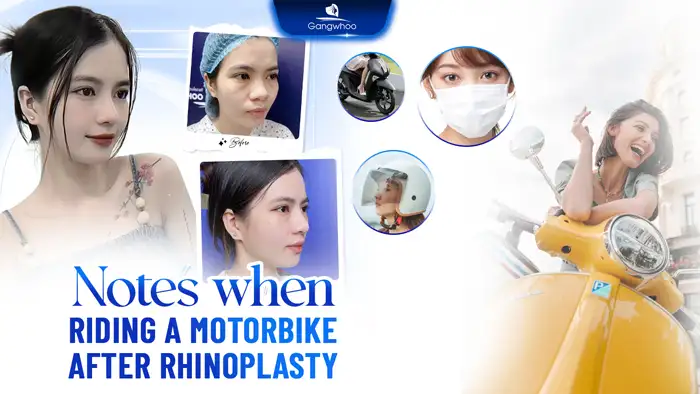 How long after rhinoplasty can you ride a motorbike? Safety tips to keep in mind when driving