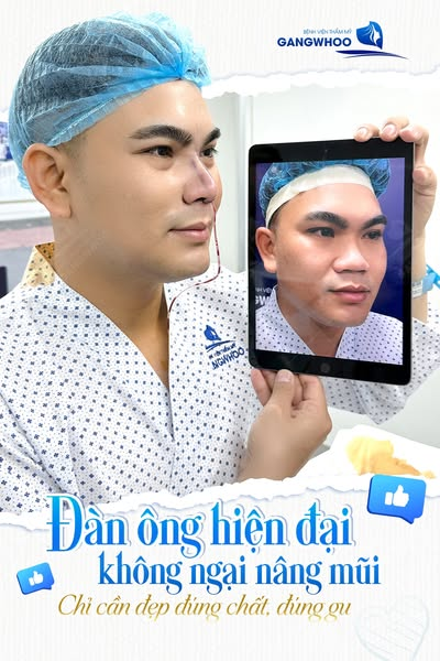 Nâng mũi bọc sụn Hàn Quốc