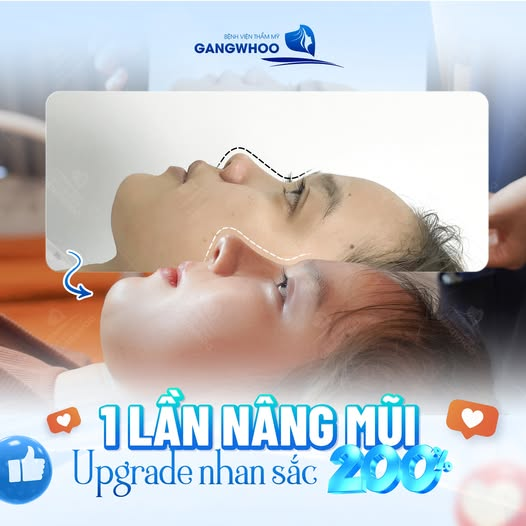 Những ai nên thực hiện nâng mũi Hàn Quốc?