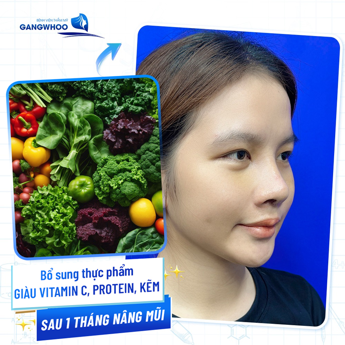 Nâng mũi kiêng ăn bao lâu? Khi nào thì có thể ăn uống bình thường lại