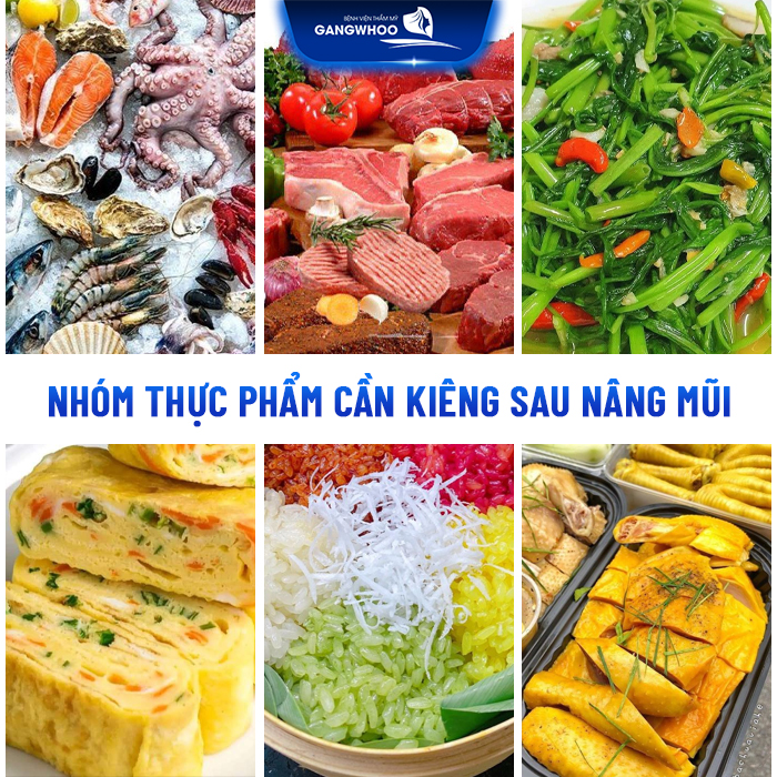 Nâng mũi kiêng ăn bao lâu? Khi nào thì có thể ăn uống bình thường lại
