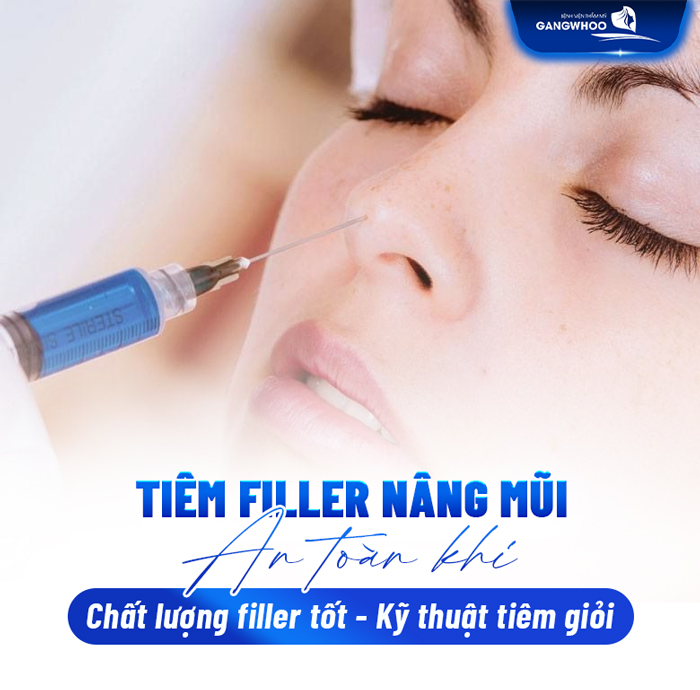 Tiêm filler nâng mũi có an toàn không, duy trì được bao lâu và có bị biến chứng không?