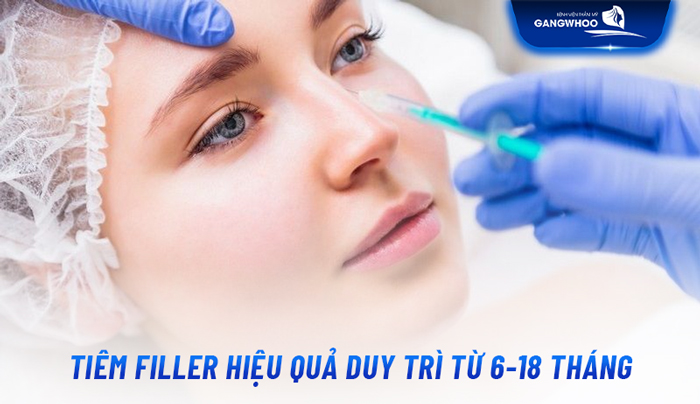 Tiêm filler nâng mũi có an toàn không, duy trì được bao lâu và có bị biến chứng không?