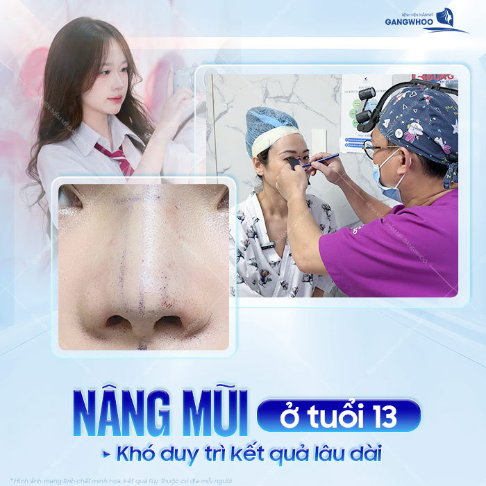 Trẻ 13 tuổi có thể nâng mũi được không? Có ảnh hưởng gì về sức khỏe không?