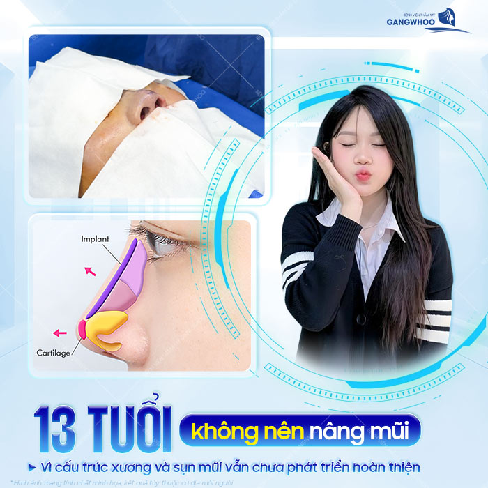 Trẻ 13 tuổi có thể nâng mũi được không? Có ảnh hưởng gì về sức khỏe không?