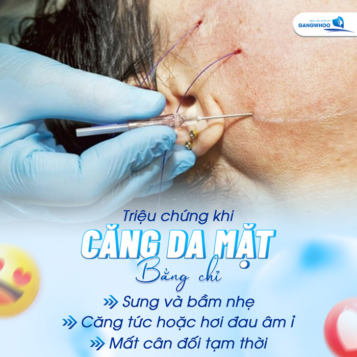 Cách Chăm Sóc Sau Khi Căng Da Mặt Bằng Chỉ: Ăn Gì, Kiêng Gì, Lưu Ý Gì?