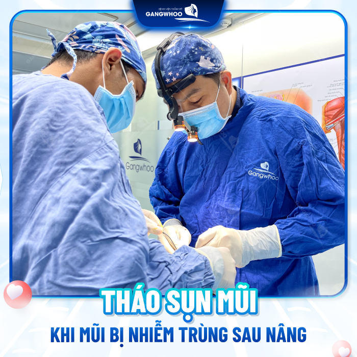 Dấu hiệu dị ứng chất liệu khi nâng mũi là gì? Cần xử lý như thế nào?