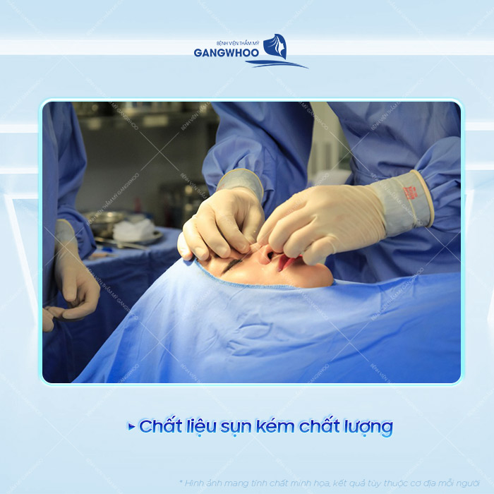 Các dấu hiệu nhận biết mũi tụt sụn sau nâng là gì? Cách xử lý như thế nào?