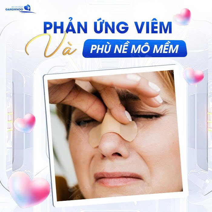 Tại sao đầu mũi bị cứng sau nâng, nguyên nhân do đâu và cách khắc phục hiệu quả