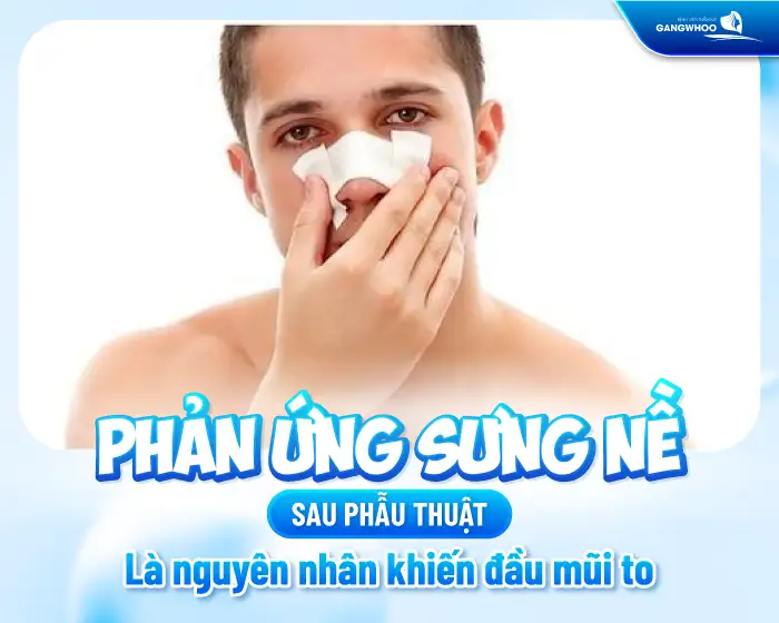 Đầu Mũi To Sau Khi Nâng Mũi Bao Lâu Thì Bình Thường?