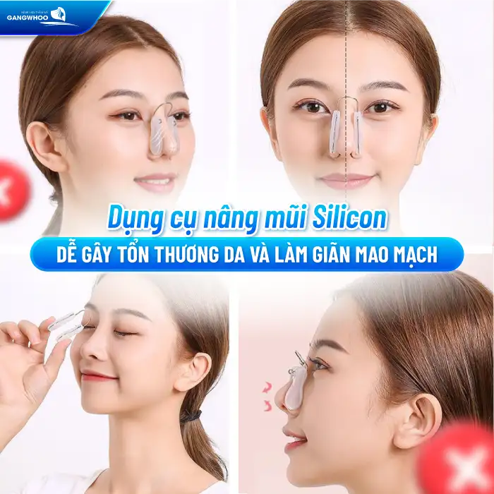 Dụng cụ nâng mũi silicon có an toàn không? 2 Dụng cụ nâng mũi silicon có an toàn không?