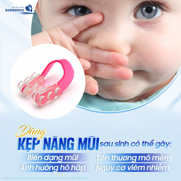 Có nên sử dụng kẹp nâng mũi cho trẻ sơ sinh? Có an toàn không? 2 Có nên sử dụng kẹp nâng mũi cho trẻ sơ sinh? Có an toàn không?