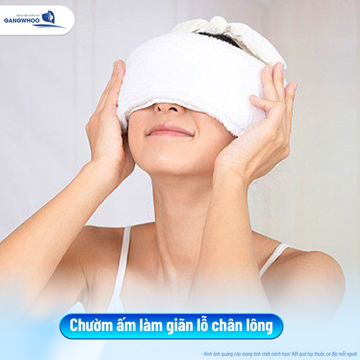 Cách trị mụn đầu đen sau khi nâng mũi hiệu quả