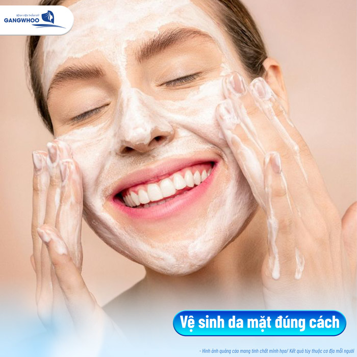 Cách trị mụn đầu đen sau khi nâng mũi hiệu quả