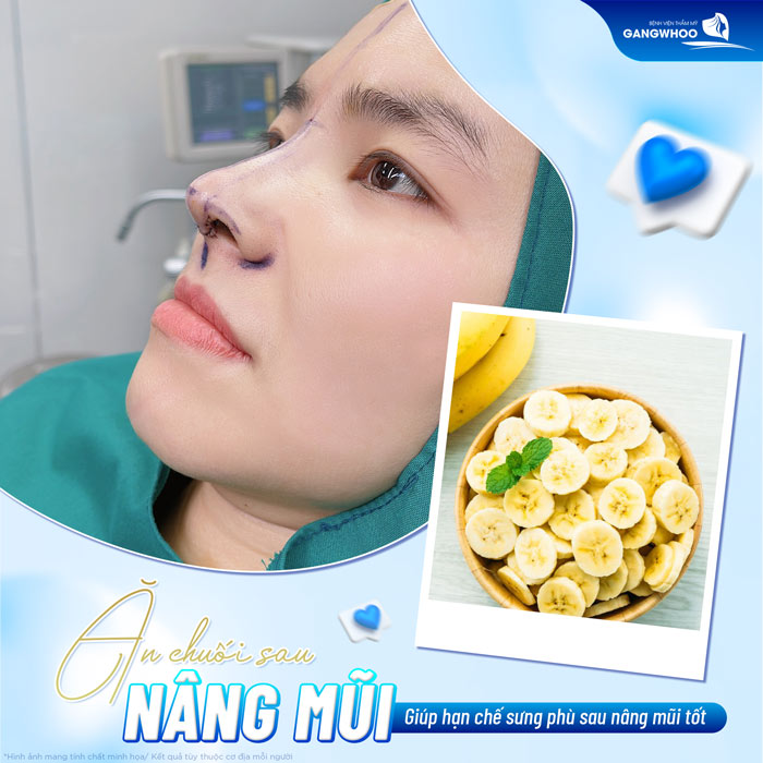 Nâng mũi ăn chuối được không? Có gây hại gì không?