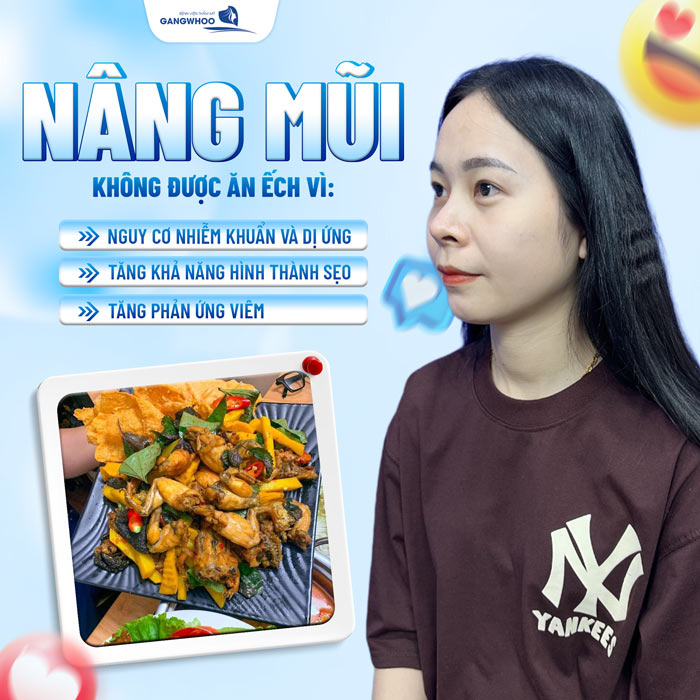 Sau khi nâng mũi ăn ếch được không? Có cần phải kiêng cử?