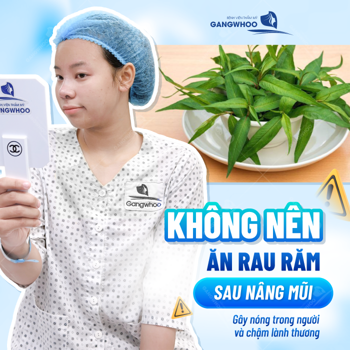 Nâng mũi ăn rau răm được không? Có cần phải kiêng cử