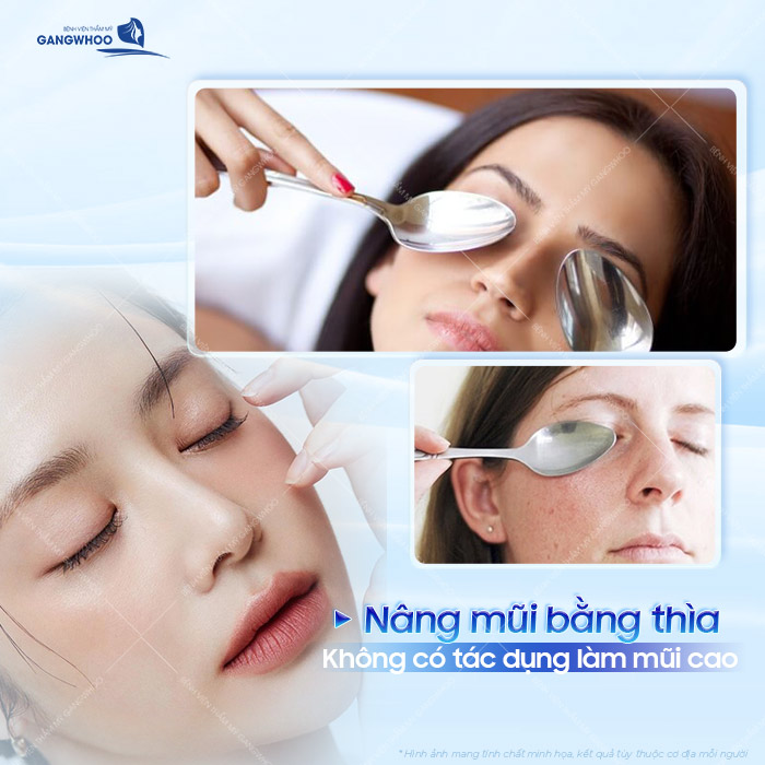 Cách nâng mũi bằng thìa có hiệu quả không? Có nên thực hiện 1 Cách nâng mũi bằng thìa có hiệu quả không? Có nên thực hiện