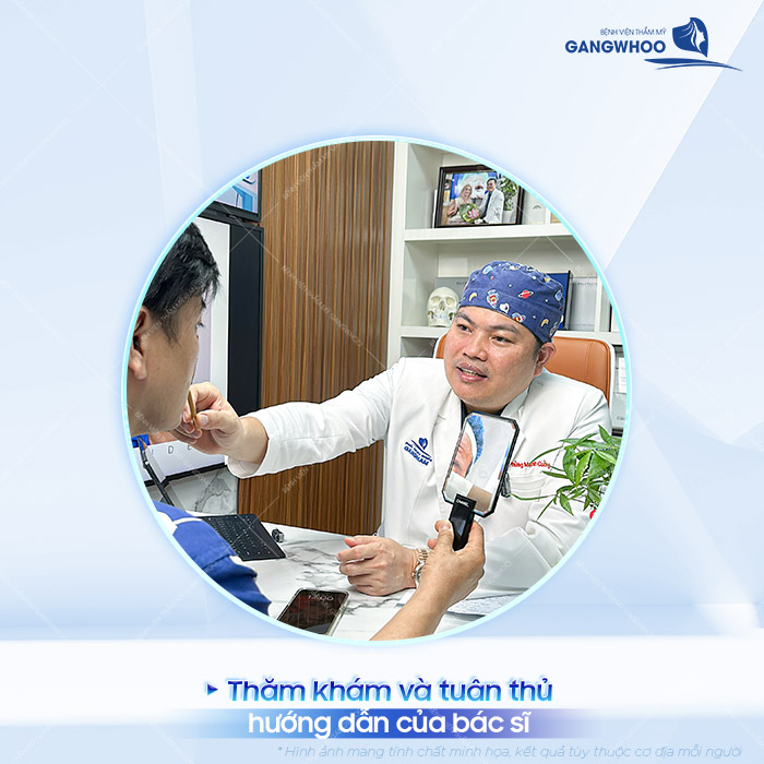 Nâng mũi bao lâu thì bị tụt sụn? Cách phòng tránh trường hợp tụt sụn sau nâng mũi 3 Nâng mũi bao lâu thì bị tụt sụn? Cách phòng tránh trường hợp tụt sụn sau nâng mũi