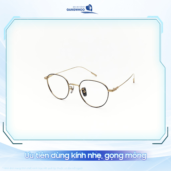 Nâng mũi bao lâu thì được đeo kính? Có cần lưu ý gì khi đeo kính?