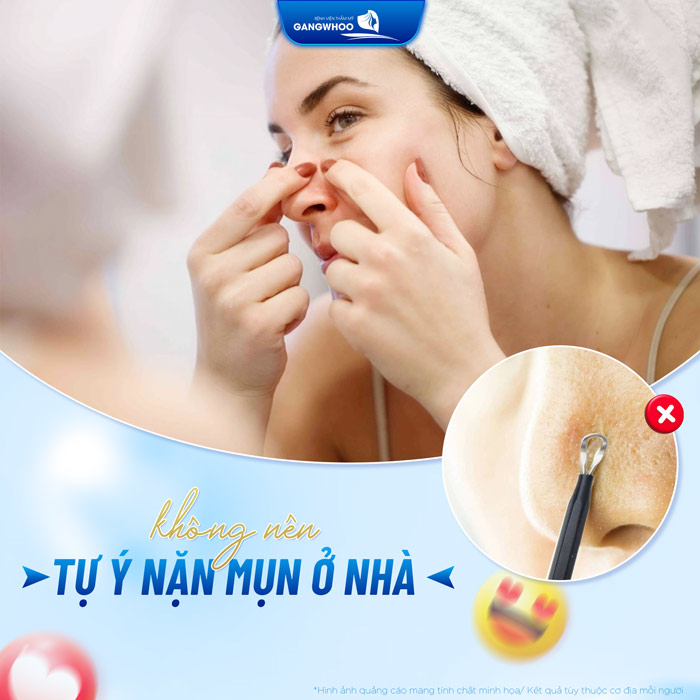 Nâng mũi bao lâu thì được nặn mụn? Có nên nặn mụn sau nâng mũi không?