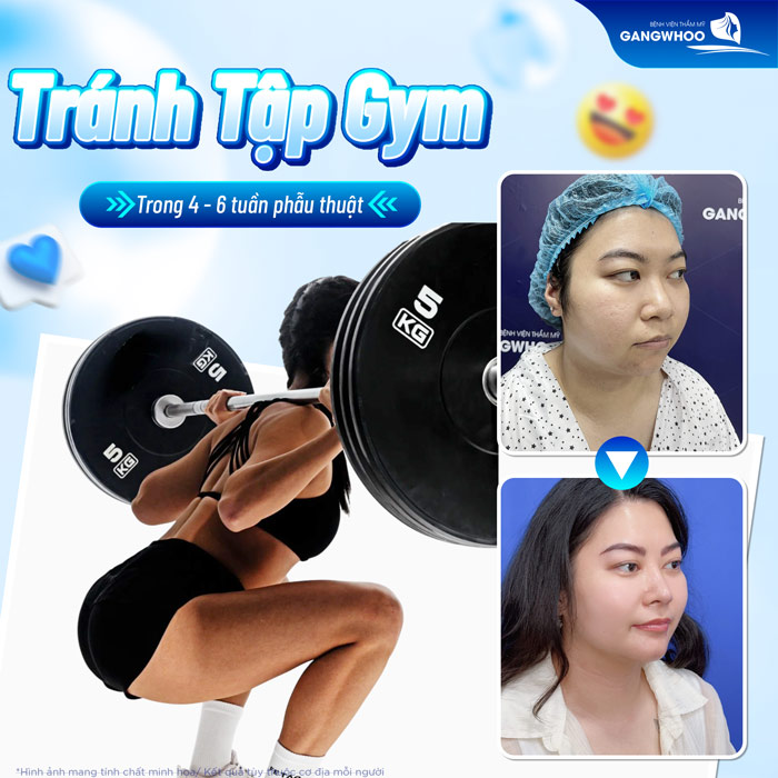 Nâng mũi bao lâu thì tập gym được và cần lưu ý gì khi bắt đầu tập luyện?
