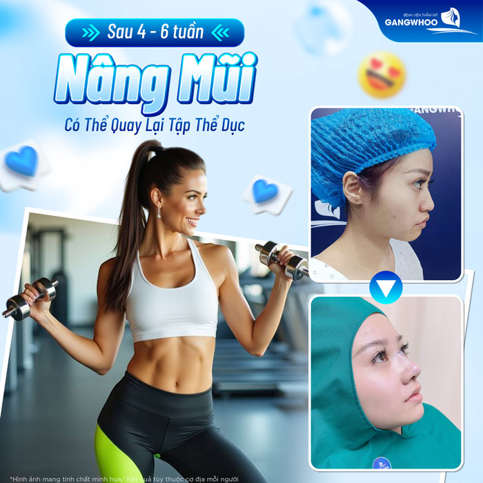 Nâng mũi bao lâu thì tập thể dục lại và nên chọn bài tập như thế nào để không làm tổn thương mũi?