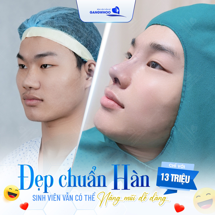 Nâng mũi cấu trúc có an toàn không? Có gây ra biến chứng nào không?