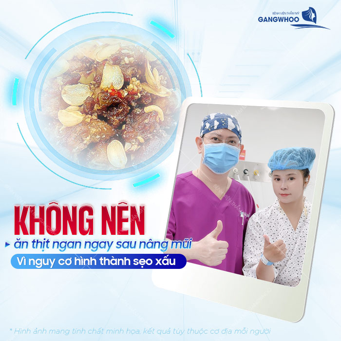 Nâng mũi có ăn được thịt ngan không? Cách lựa chọn thực phẩm phù hợp sau nâng mũi