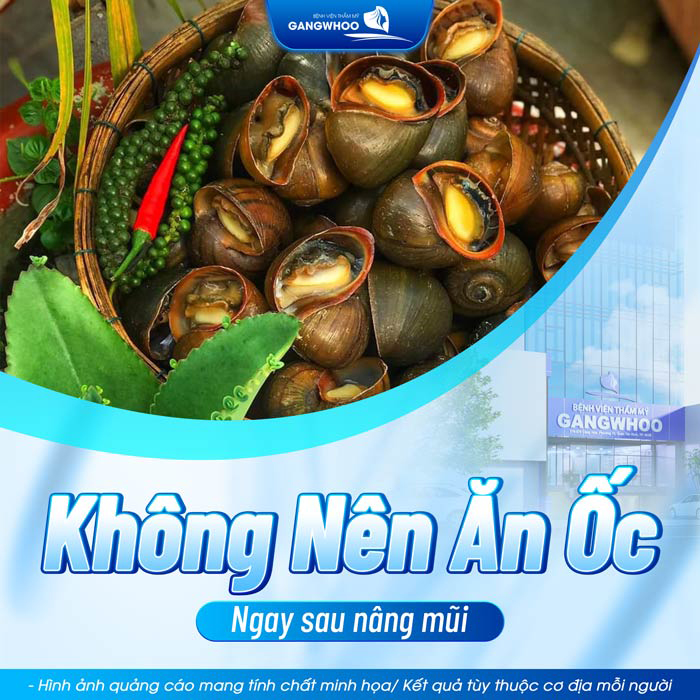 Nâng mũi có ăn ốc được không?