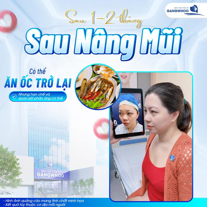 Nâng mũi có ăn ốc được không?