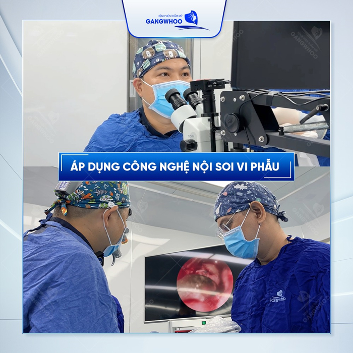 Nâng mũi có an toàn không? Có nên thực hiện nâng mũi không?