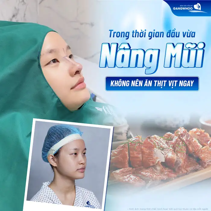 Nâng mũi có được ăn thịt vịt không? Có cần phải kiêng không? 1 Nâng mũi có được ăn thịt vịt không? Có cần phải kiêng không?