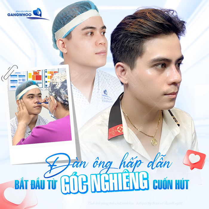 Nâng mũi sụn sinh học là gì? Nâng mũi sụn sinh học có tốt không