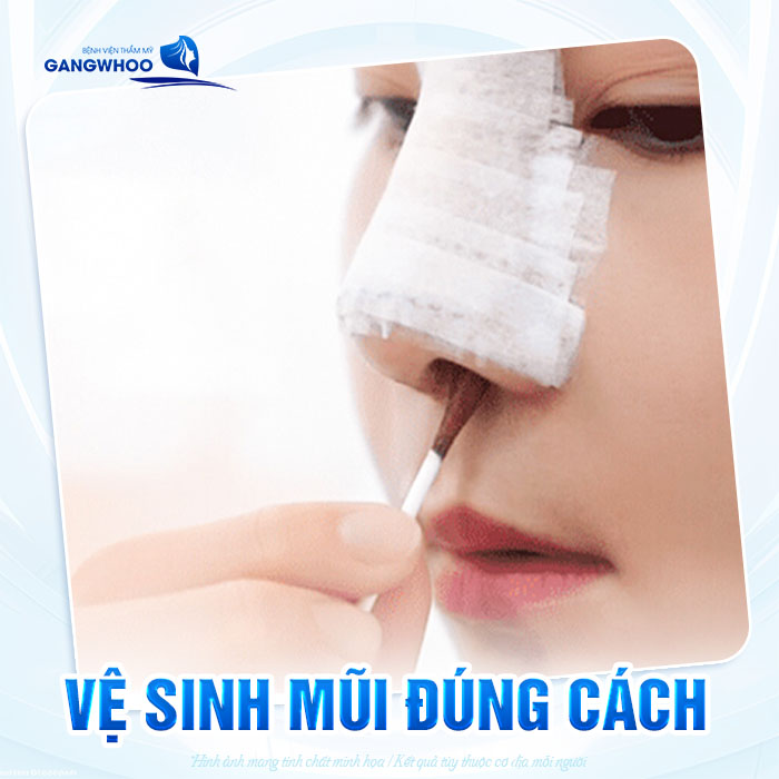 Ngứa mũi sau khi nâng có phải dấu hiệu bình thường không?