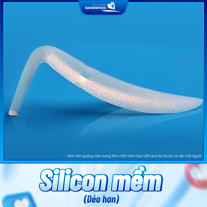 Sụn silicon nâng mũi có những loại nào? Loại nào tốt nhất