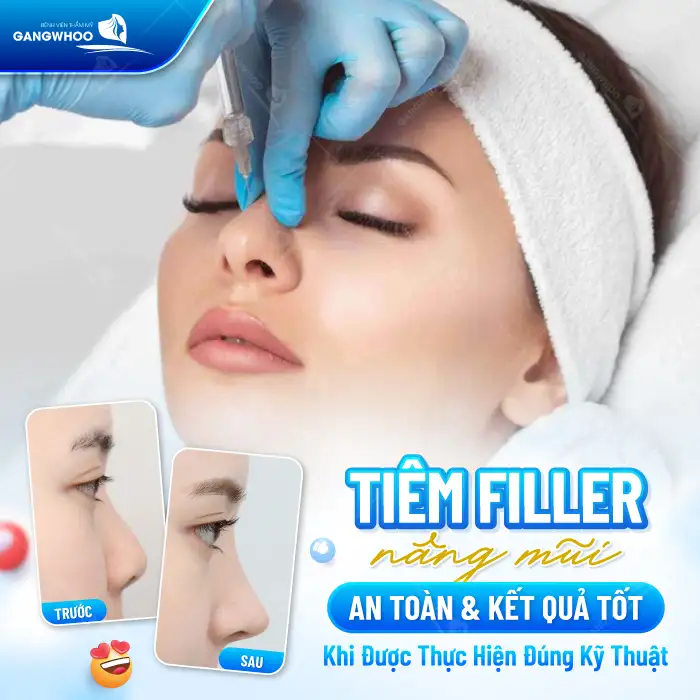 Tiêm nâng mũi có hại không? Những rủi ro và biến chứng có thể gặp phải?