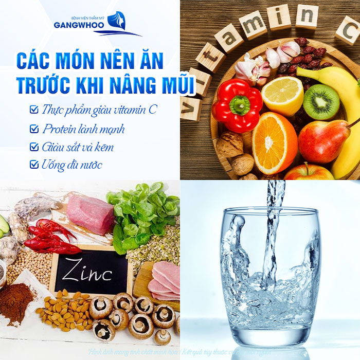 Trước khi nâng mũi nên ăn gì để sức khỏe tốt và phục hồi nhanh?