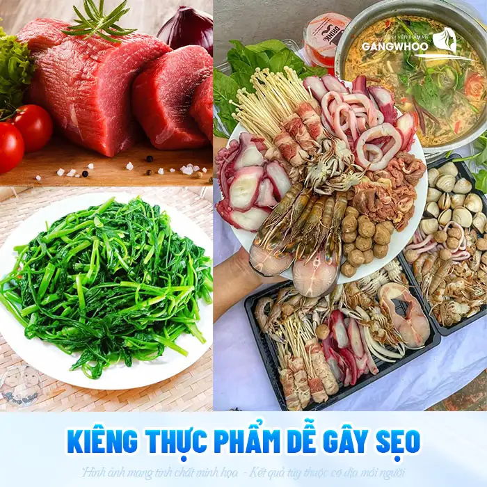 Nâng mũi có véo mũi được không? Bao lâu thì được vặn vẹo mũi