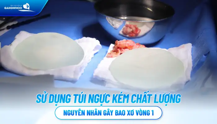 Tình trạng bao xơ khi nâng ngực là gì? Nguyên nhân bị bao xơ là gì?