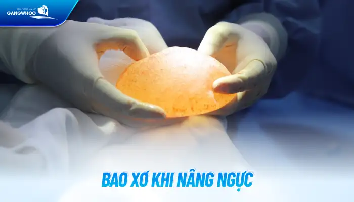 Tình trạng bao xơ khi nâng ngực là gì? Nguyên nhân bị bao xơ là gì?