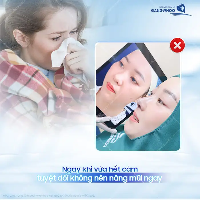 Bị cảm có nâng mũi được không? Có gây ra biến chứng gì không?