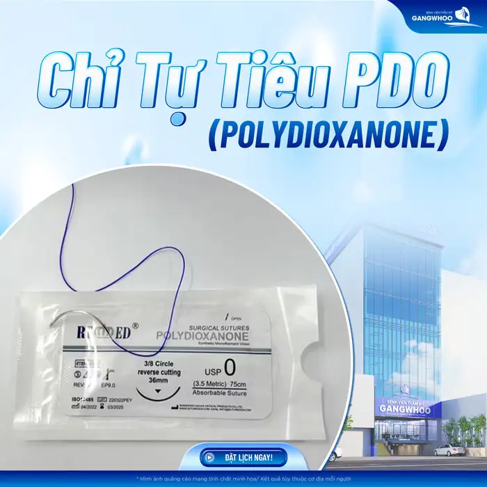 Các loại chỉ căng da mặt hiện nay là gì? Nên lựa chọn loại chỉ nào an toàn?