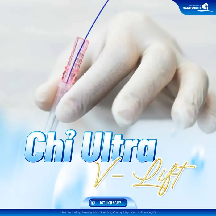 Các loại chỉ căng da mặt hiện nay là gì? Nên lựa chọn loại chỉ nào an toàn?