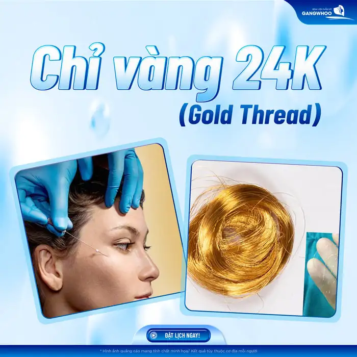 Các loại chỉ căng da mặt hiện nay là gì? Nên lựa chọn loại chỉ nào an toàn?