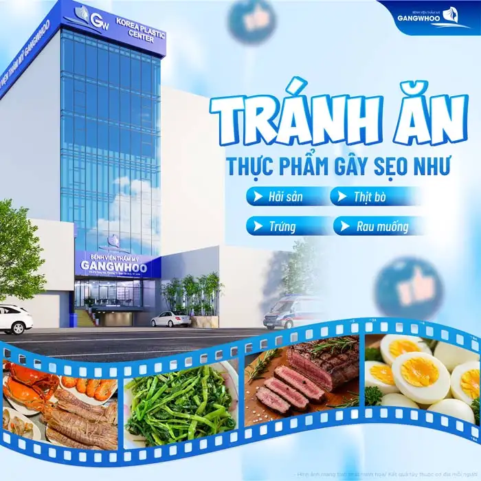 Cách chăm sóc mí mắt sau khi cắt chỉ ra sao? Cần lưu ý những gì?