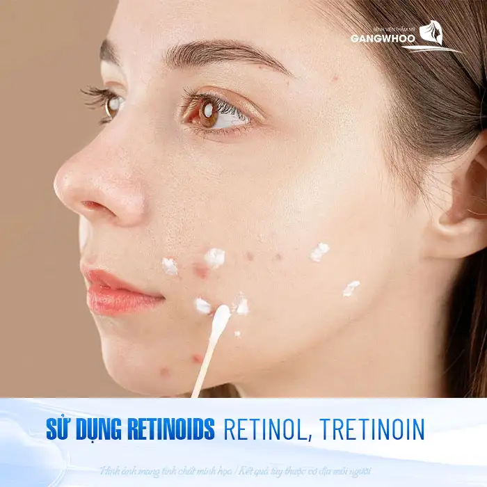 9+ Cách điều trị mụn ẩn dưới da hiệu quả, đơn giản