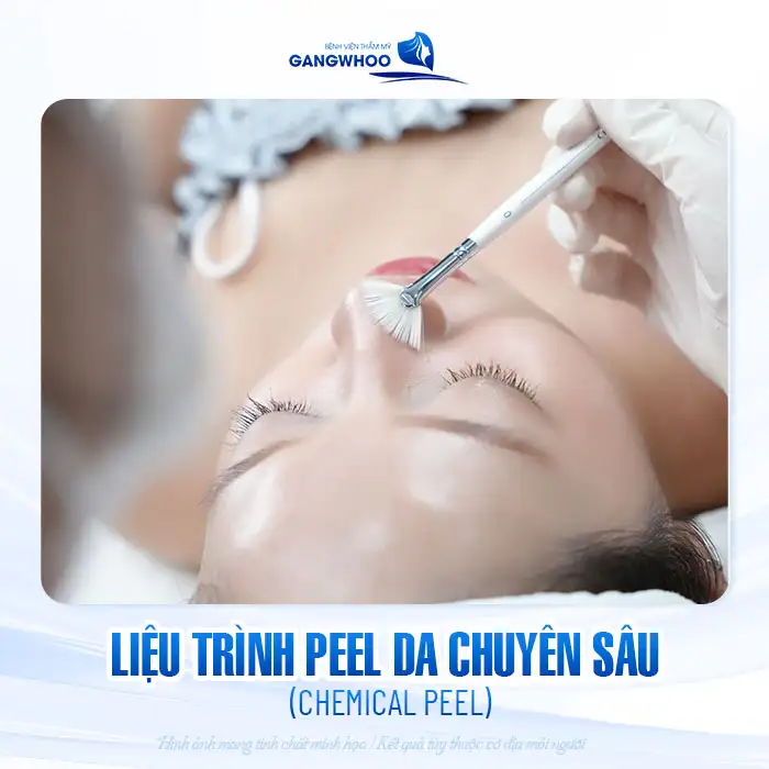 9+ Cách điều trị mụn ẩn dưới da hiệu quả, đơn giản